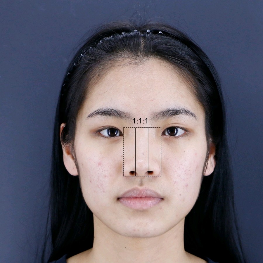 拯救你的鼻子这样子的鼻翼才好看