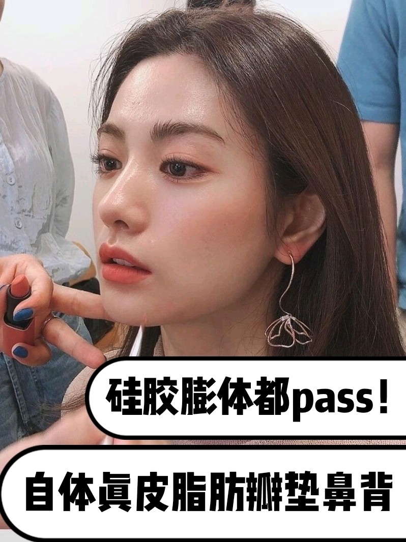 硅胶膨体都pass 自体真皮脂肪瓣垫鼻背 最近兔 圈子 新氧美容整形