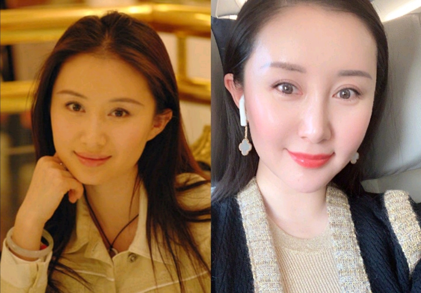 在脂肪填充上"翻过车"的明星有哪些?