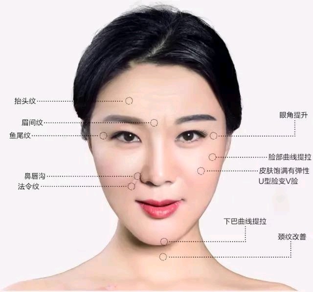 线雕面部提升与传统拉皮手术比起来优势有哪些?