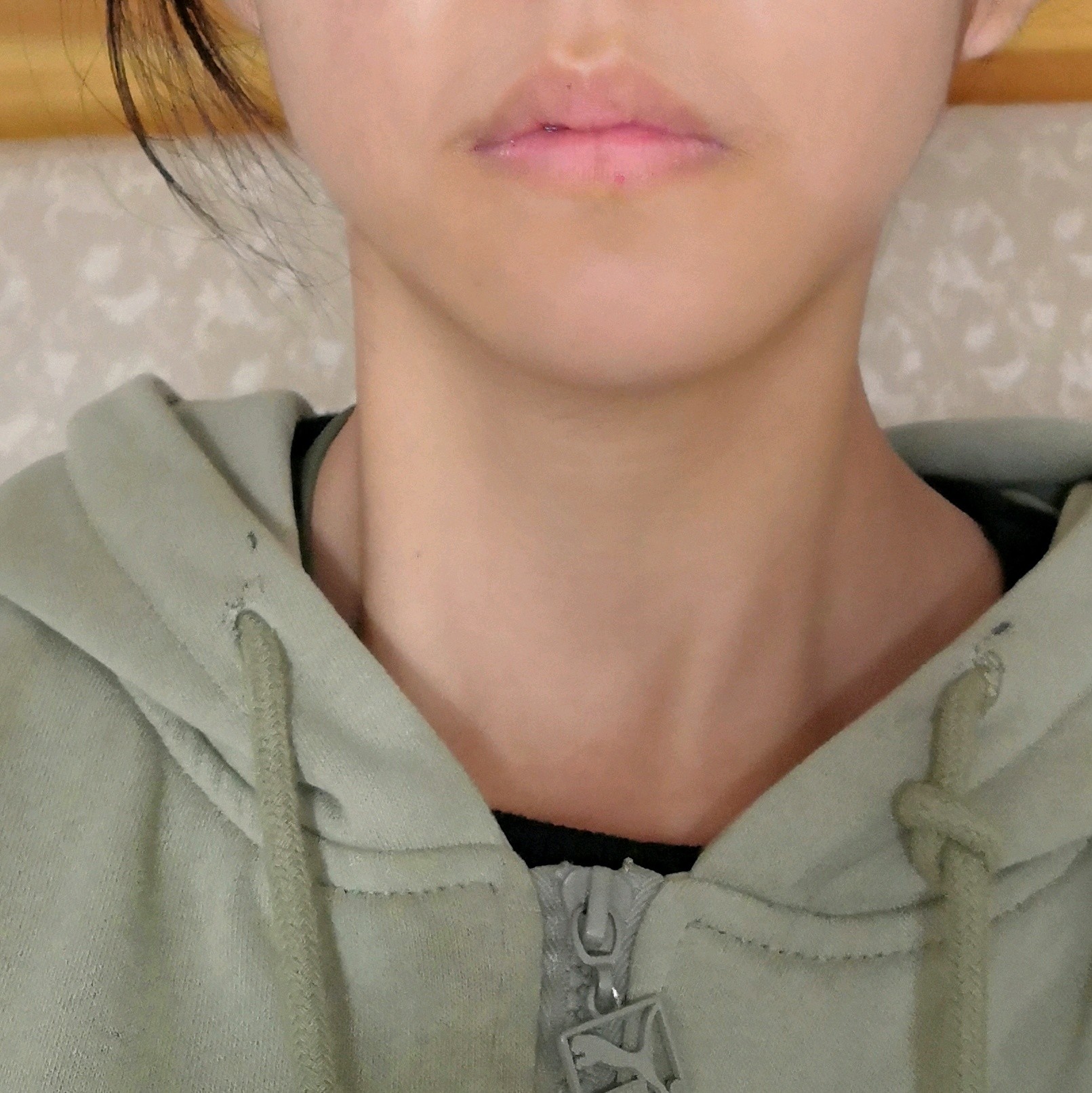 我面部看起来嘴巴不对称,下巴歪是否与牙齿咬合有关?应该怎么去调整?