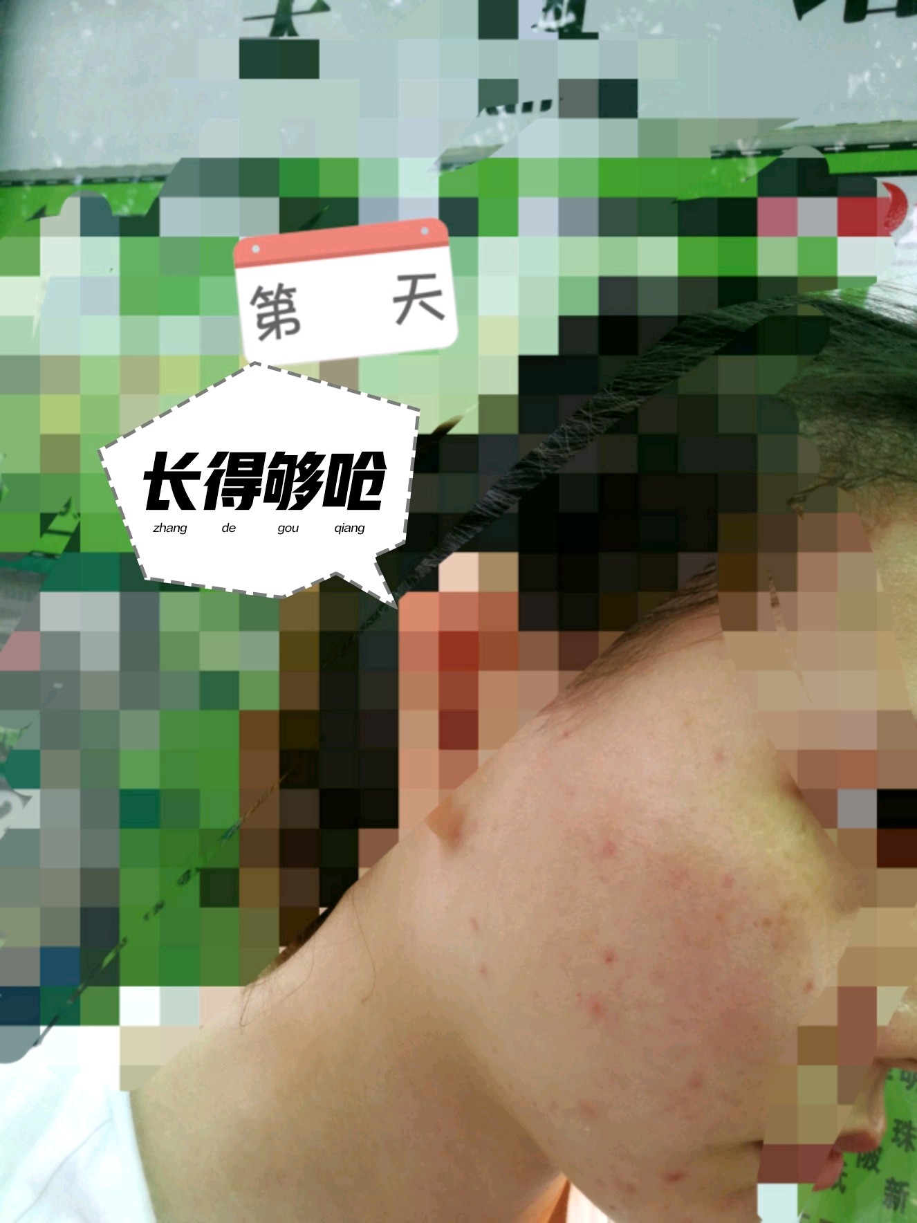 针清前后的对比还是很大的.