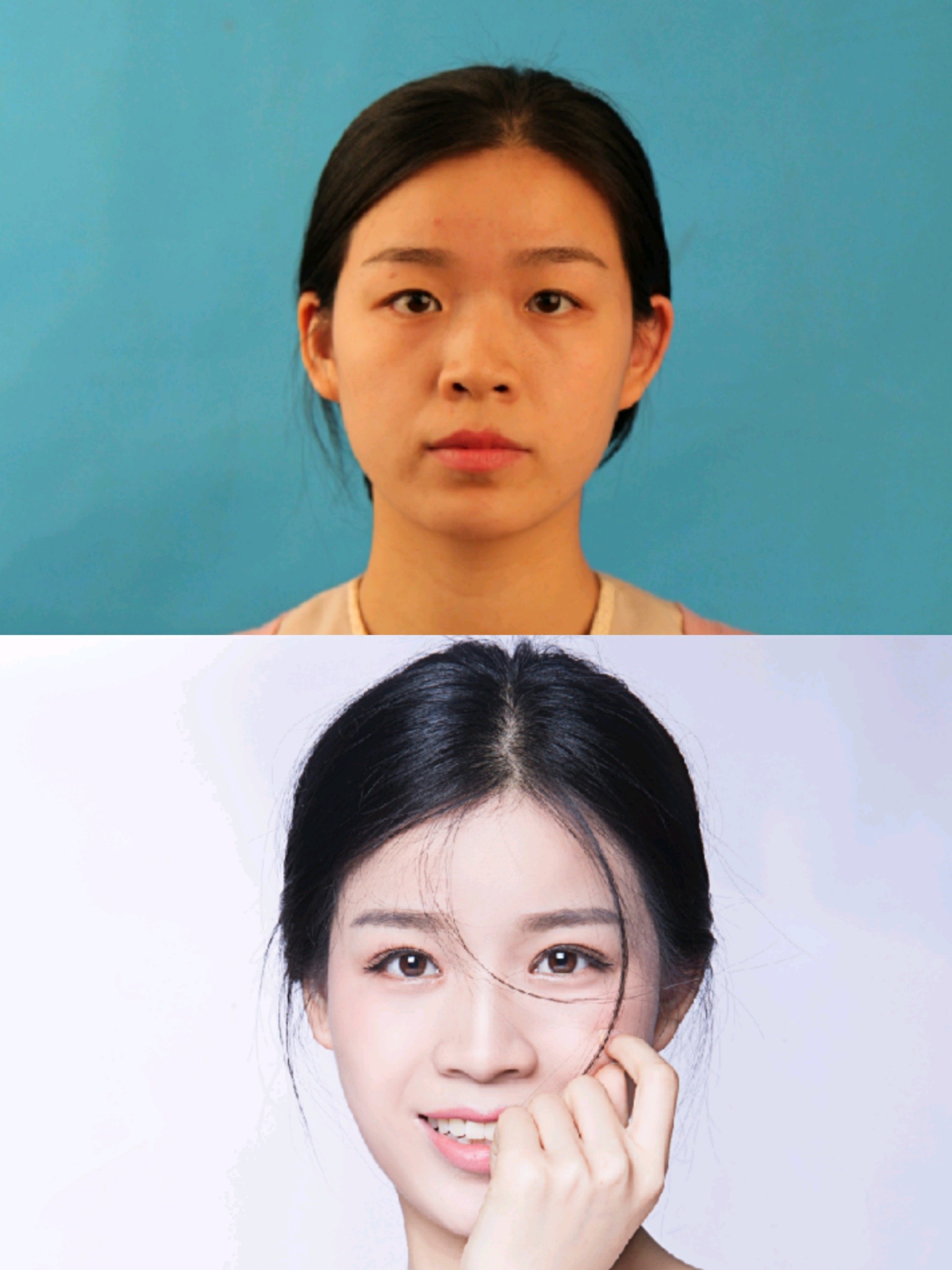 内幕深扒70%医生都拒绝的开外眼角到底有什么不好