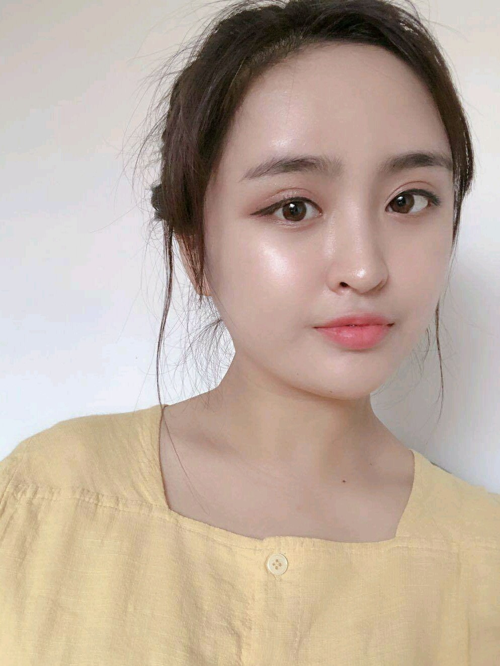 苹果肌与高颧骨的区别在哪里?