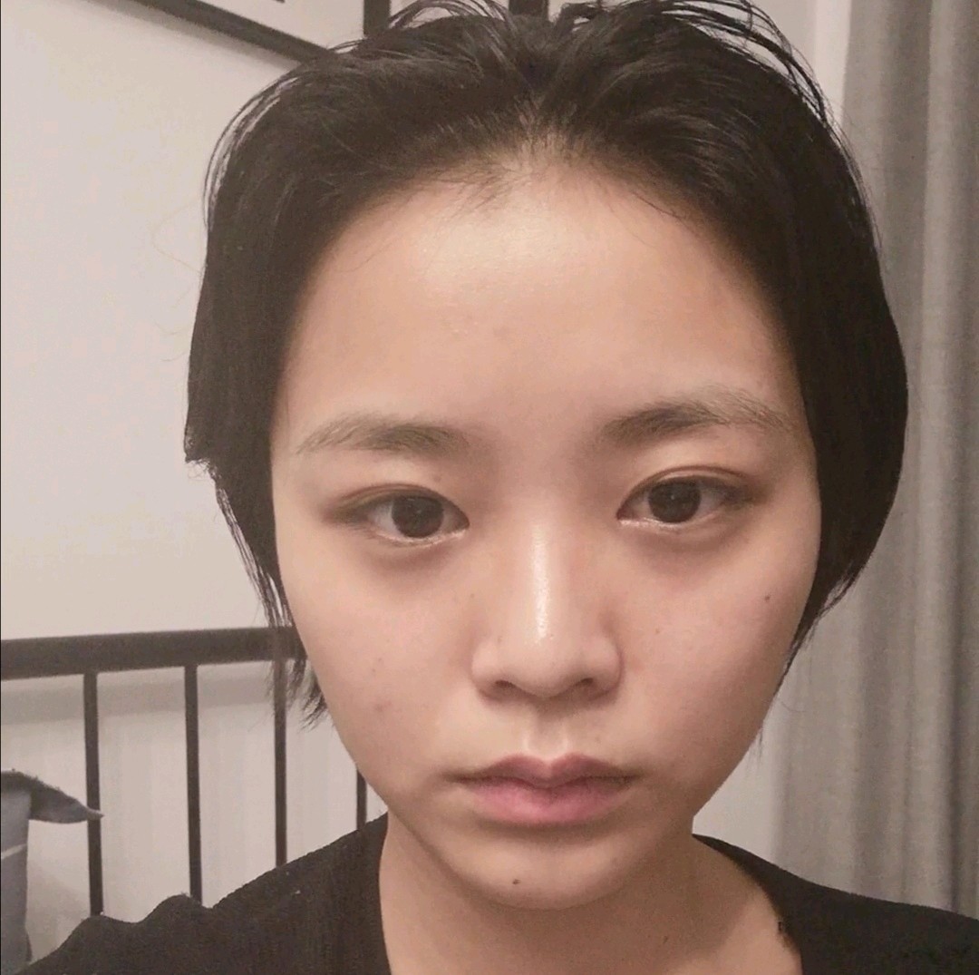 高低眼大小脸一边脸鼓一边脸扁