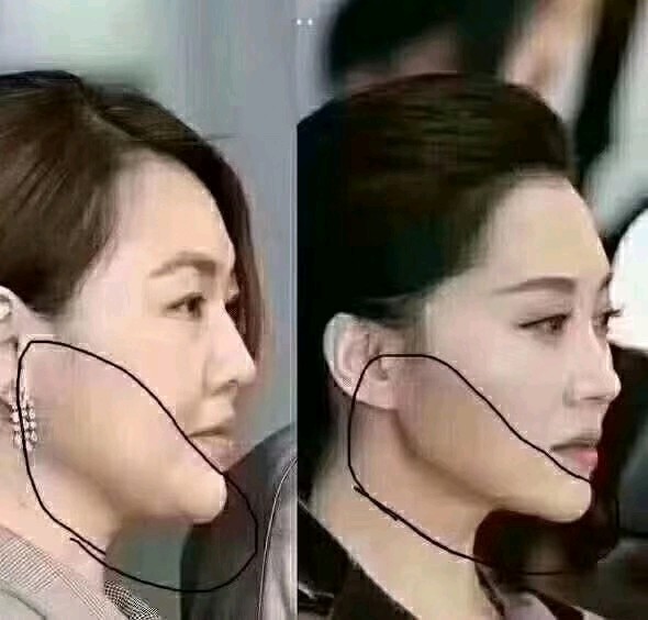 轮廓线,又称:少女线.