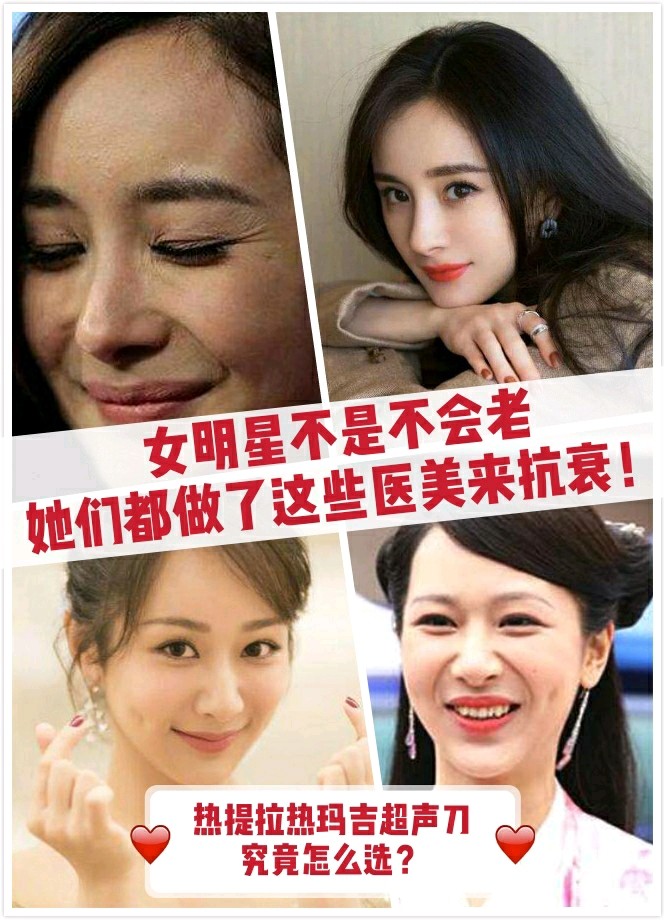 为什么女明星越活越年轻71因为她们都做了这些医美抗衰_圈子-新氧