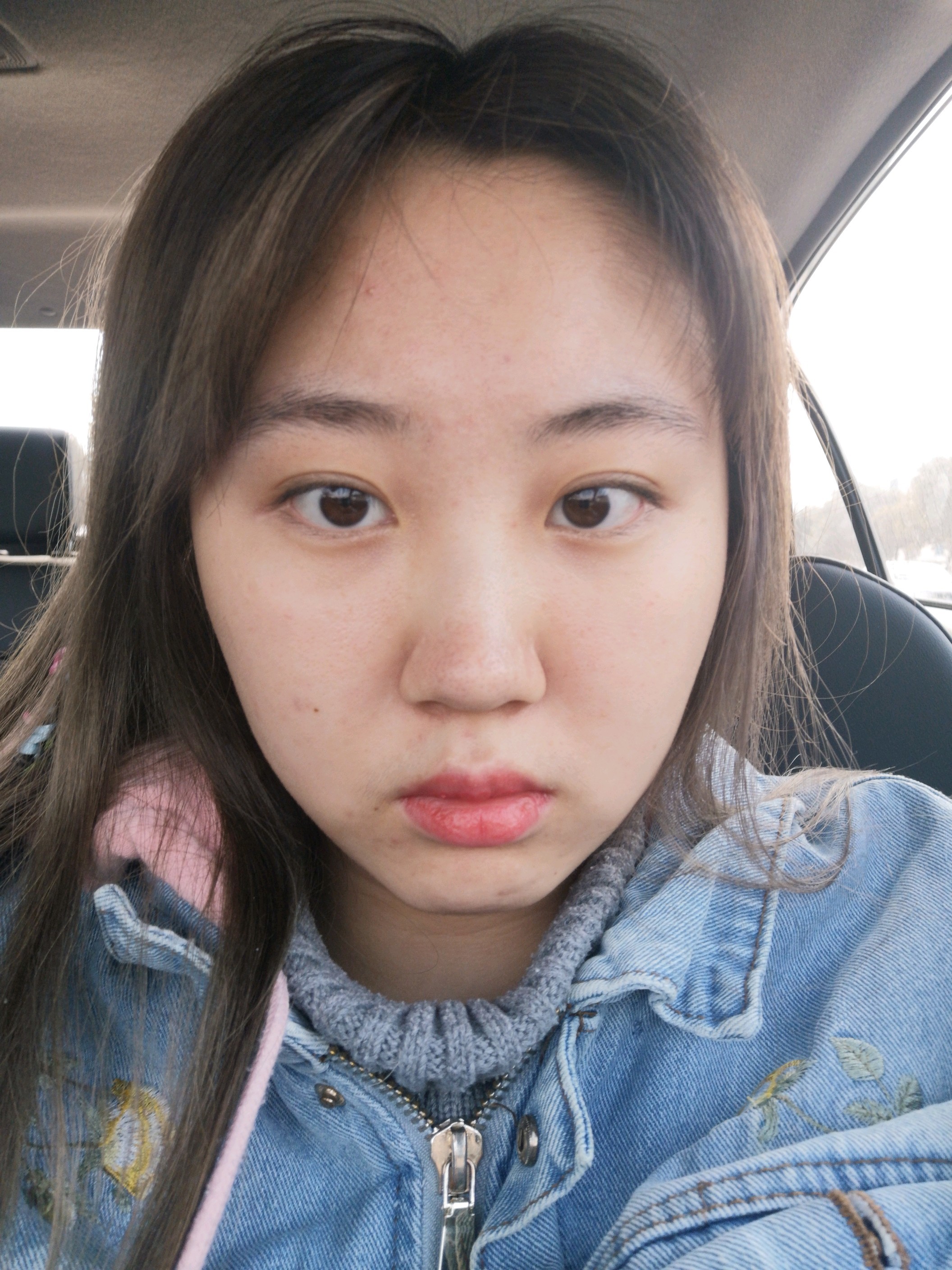 脸大五官不立体年纪轻轻就有泪沟和法令纹