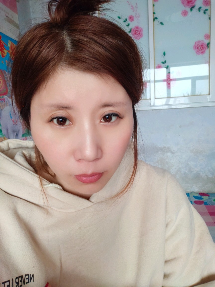 太阳穴凹陷,颧骨突出,脸比较宽,额头窄,眼睛与眉毛_圈子-新氧美容整形