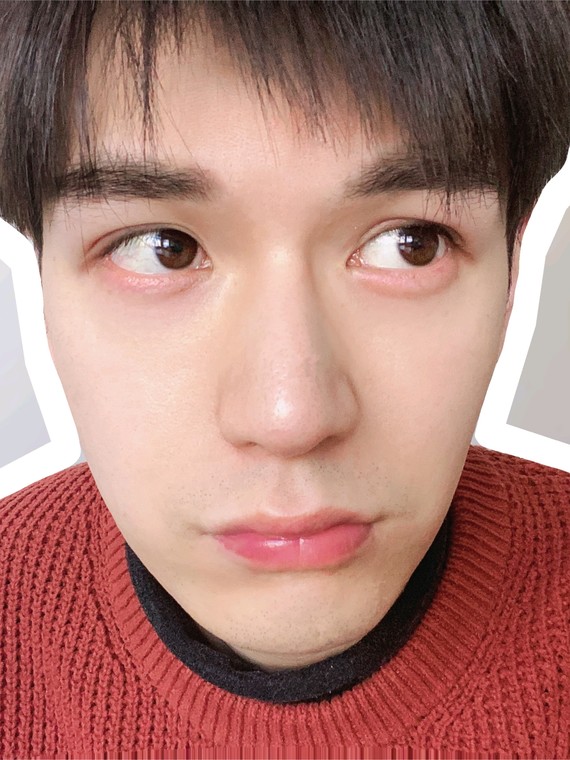 98脱单双需要做哪些功课07,这里小结几点割双眼皮建议_圈子-新氧