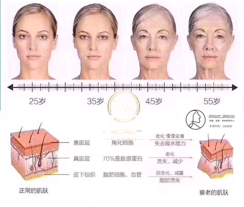 衰老在面部的主要表现为皮肤松弛,下垂,骨质疏松,韧带松弛以及脂肪