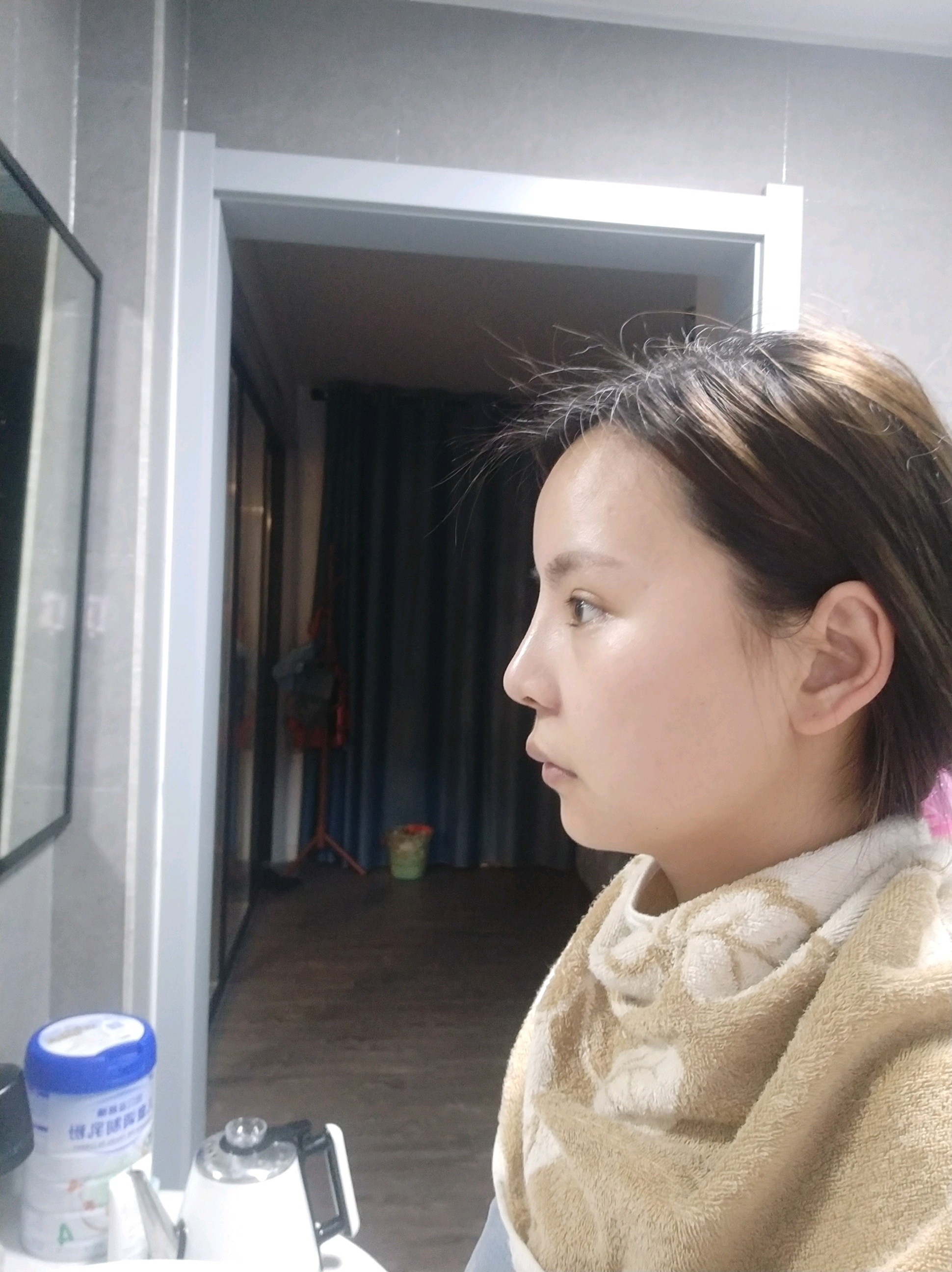 半肋骨隆鼻的一个半月,鼻子没有线条感直挺挺的,鼻根_圈子-新氧美容