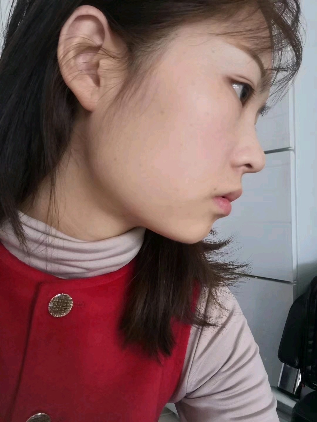 我太需要一个牙齿矫正了,这个嘴是不是很凸