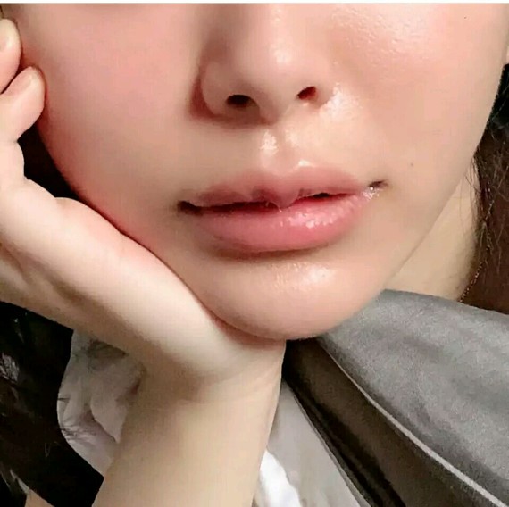 想做baby同款微笑唇,结果好像有点不太一样98杨颖_圈子-新氧美容