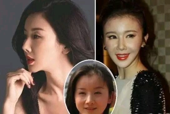 【曾古装第一美人孙菲菲】