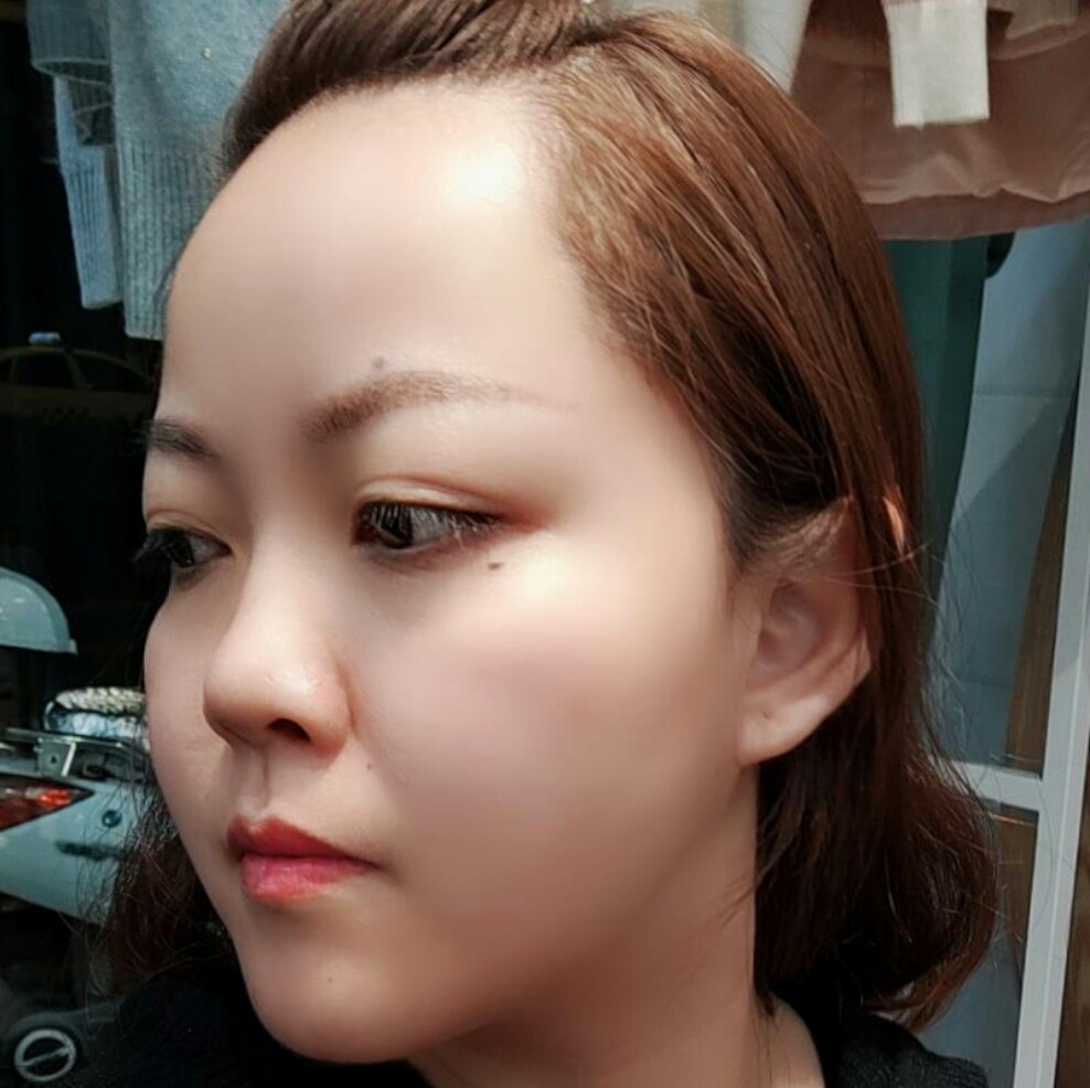 肉肉脸谁人都不想,但是如果是天生肉脸也无可奈何,最_圈子-新氧美容