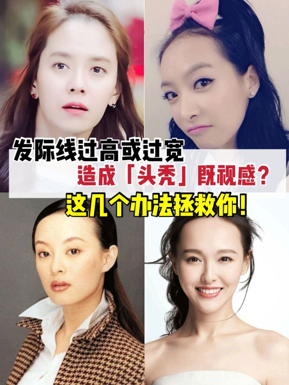 发际线过高或过宽?这几个办法拯救你!