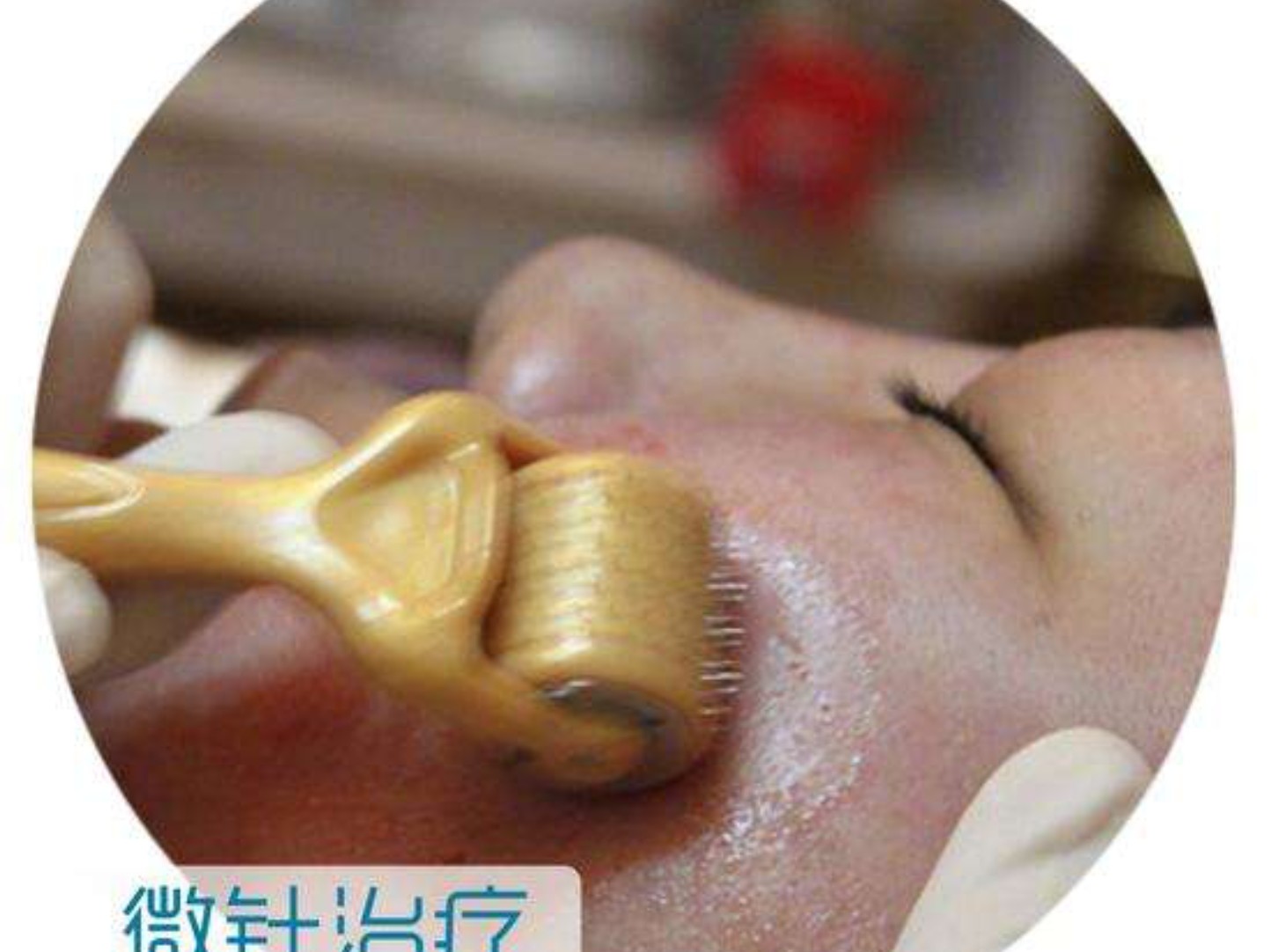 你们的平价又有_圈子-新氧美容整形