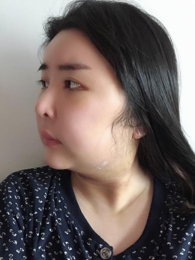 面吸,7天