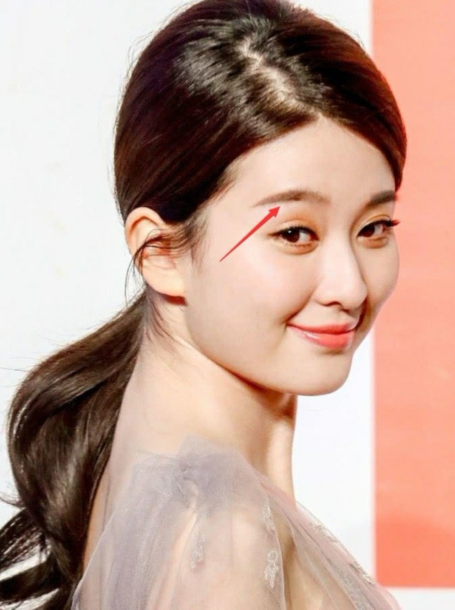 93乔欣从双眼无神的"丑小鸭"逆袭成"白富美",靠的_圈子-新氧美容