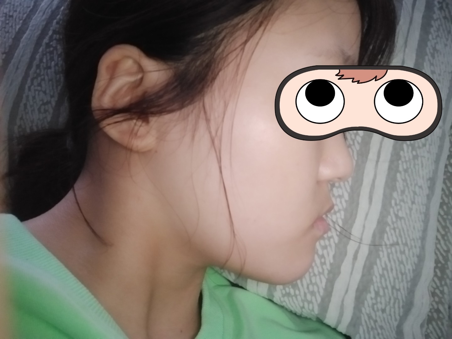 想了解一下这个月牙脸有救吗?