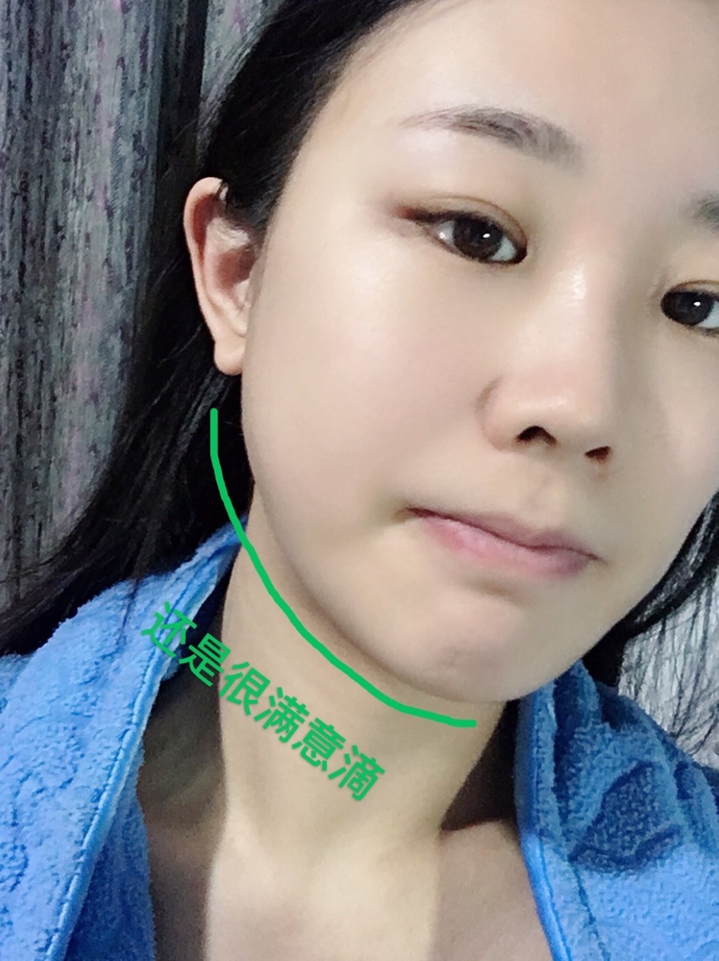 看我的下颌线,太好看了,轮廓出来了,整个人气质都不一样了,真的太感谢