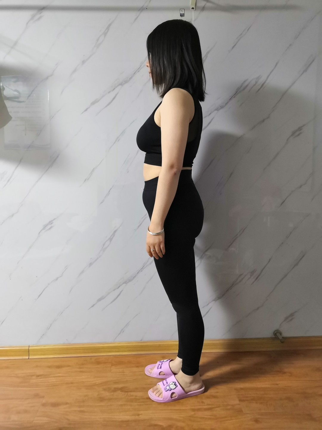 day1初始报告体重49.4kg身高152cmbm_圈子-新氧美容整形