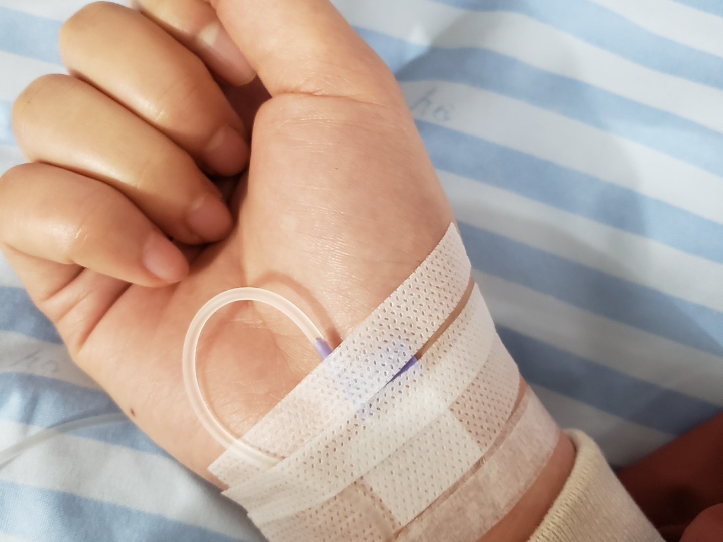 天天打消炎针的我手已经插不进血管了,医生说接下来会越来越肿