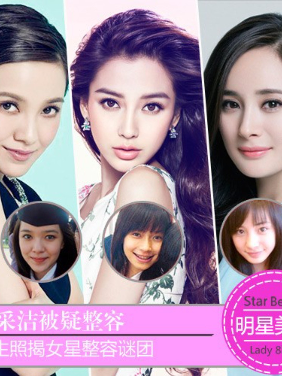 众所周知,人的样貌是天生的,是父母给予的,有些人一_圈子-新氧美容