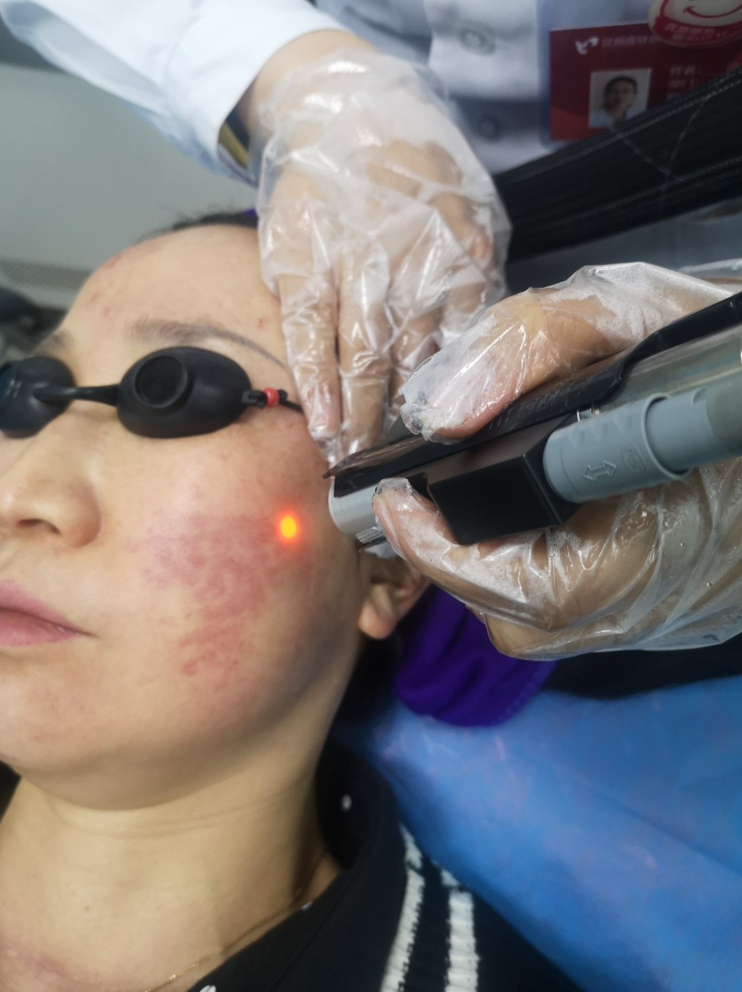 这是我第三次过来做这个激光了,不得不说效果真的太好_圈子-新氧美容