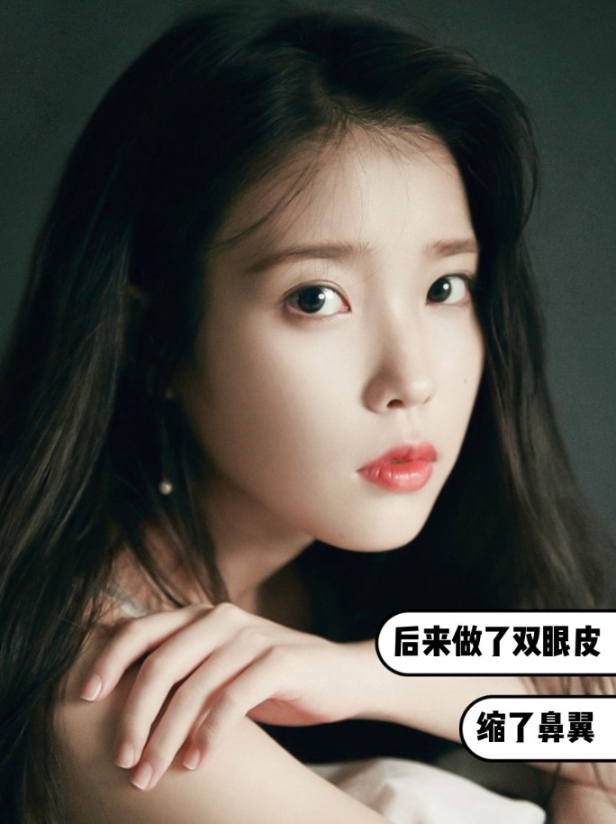 iu就是极为成功的一例,虽然本人只承认割了双眼皮,但明眼人(比如你我)
