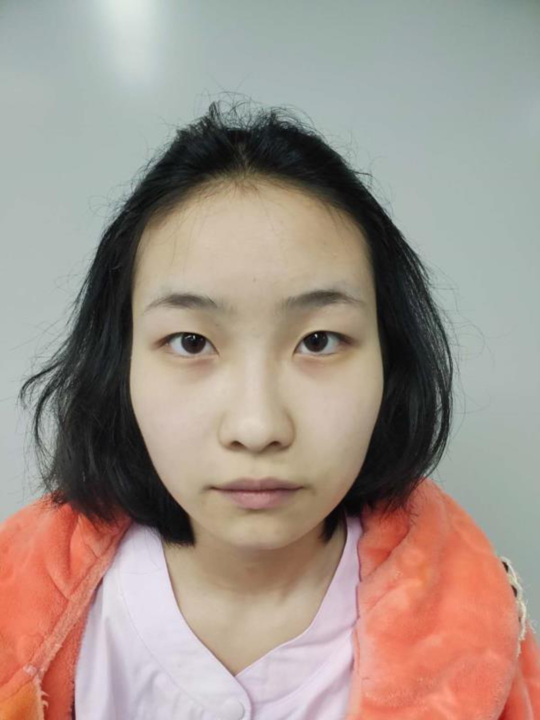 从小就是单眼皮女生,超级羡慕那些双眼皮大眼睛的姑娘_圈子-新氧美容