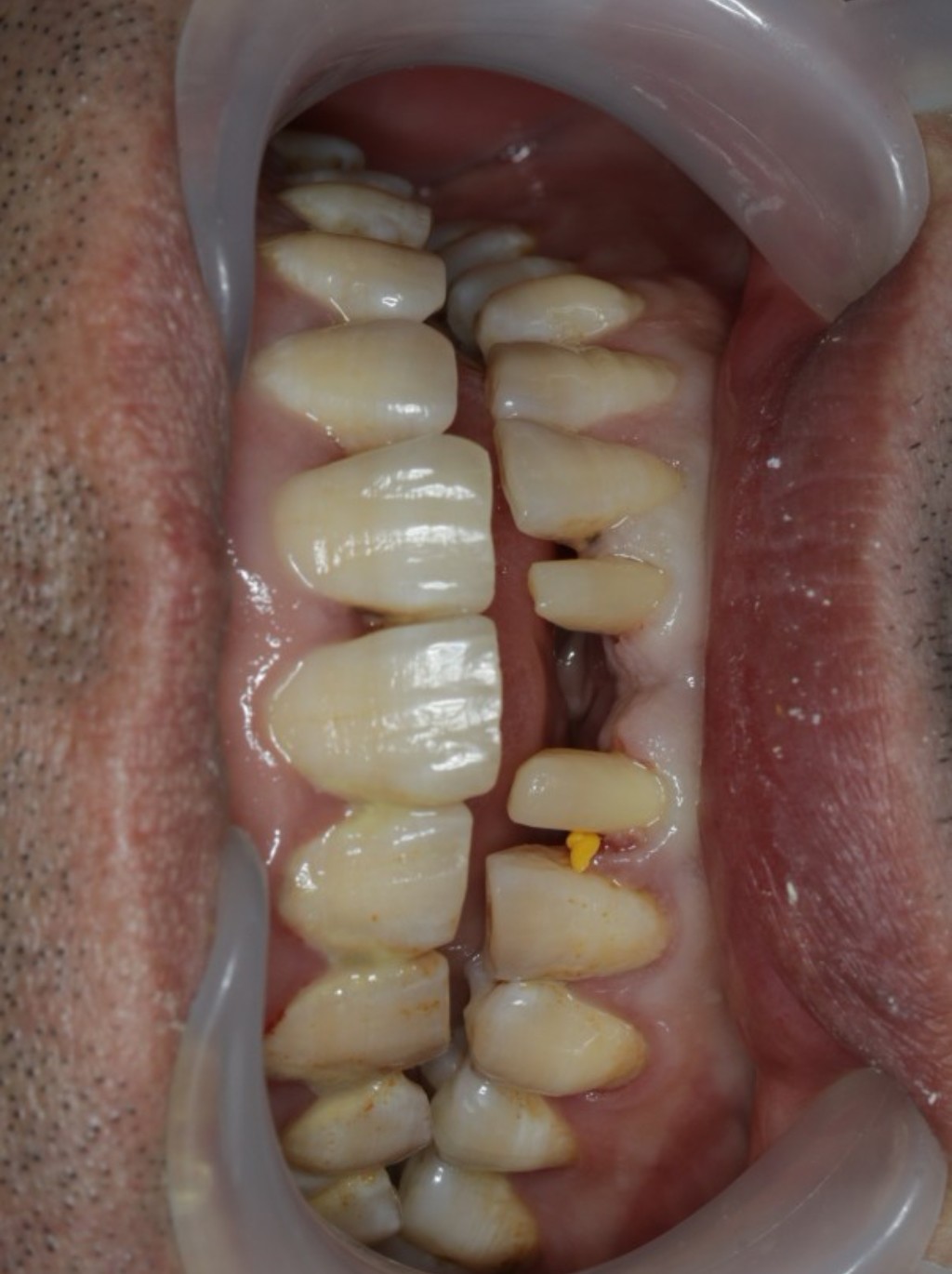 1024_1370竖版 竖屏