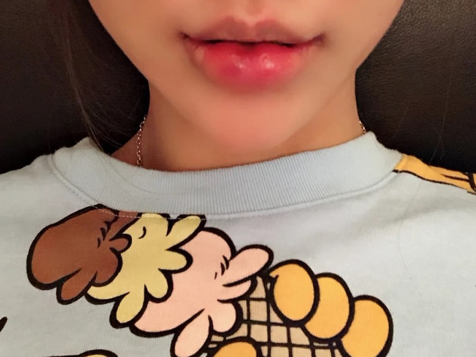 我也没有对自己嘴巴有啥不满意就觉得年纪大后,嘴角开_圈子-新氧美容