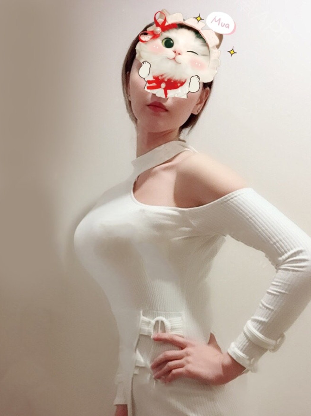 【术后第34天】做完自体脂肪隆胸的第34天了,在做_圈子-新氧美容整形