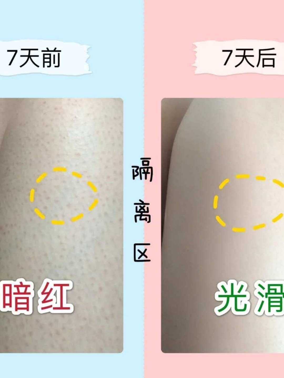鸡皮肤还有用吗(鸡皮肤用什么有效果)