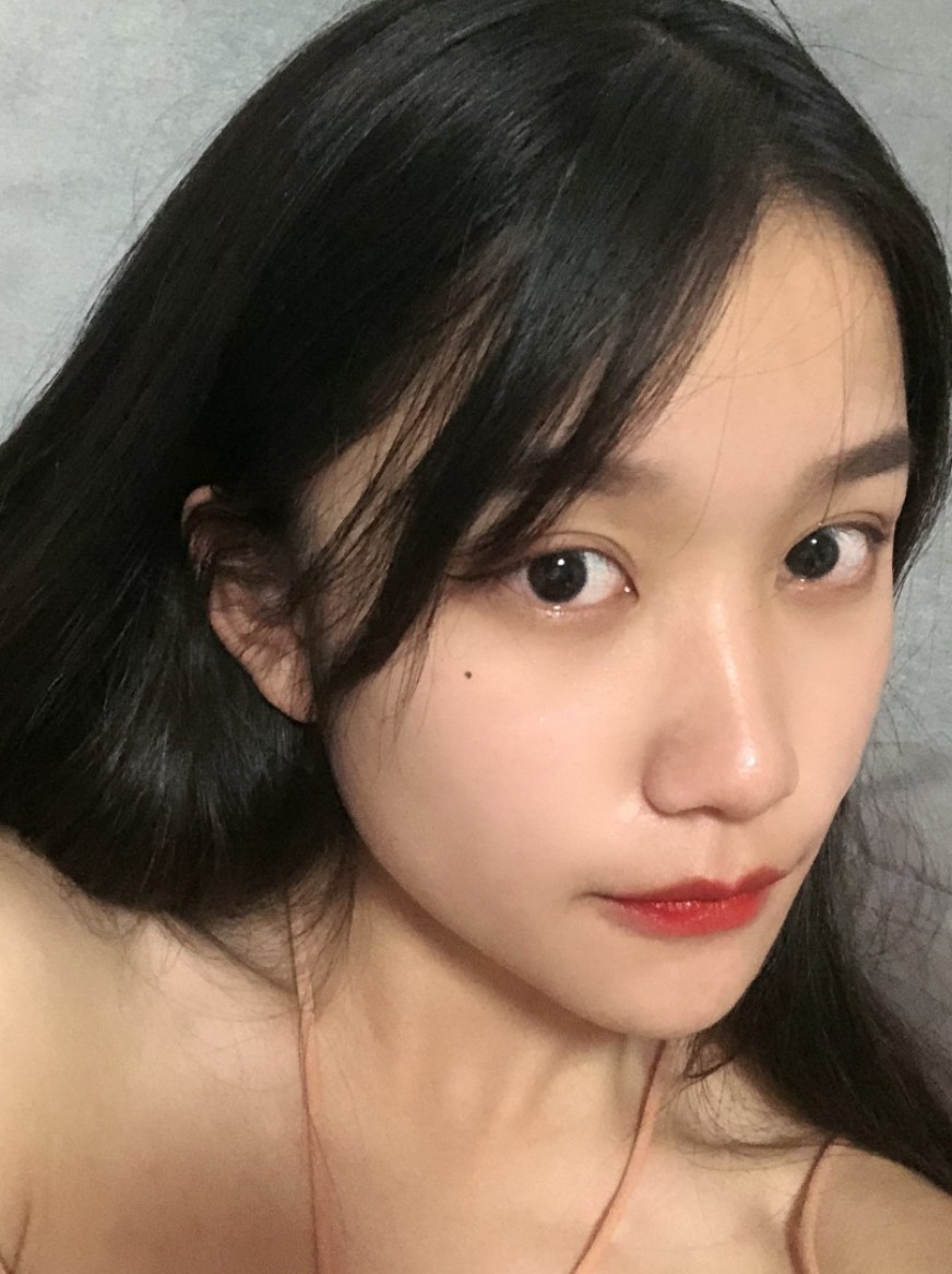 术后90天 最近在网上看到刘亦菲的素颜淡妆真的很_圈子-新氧美容整形