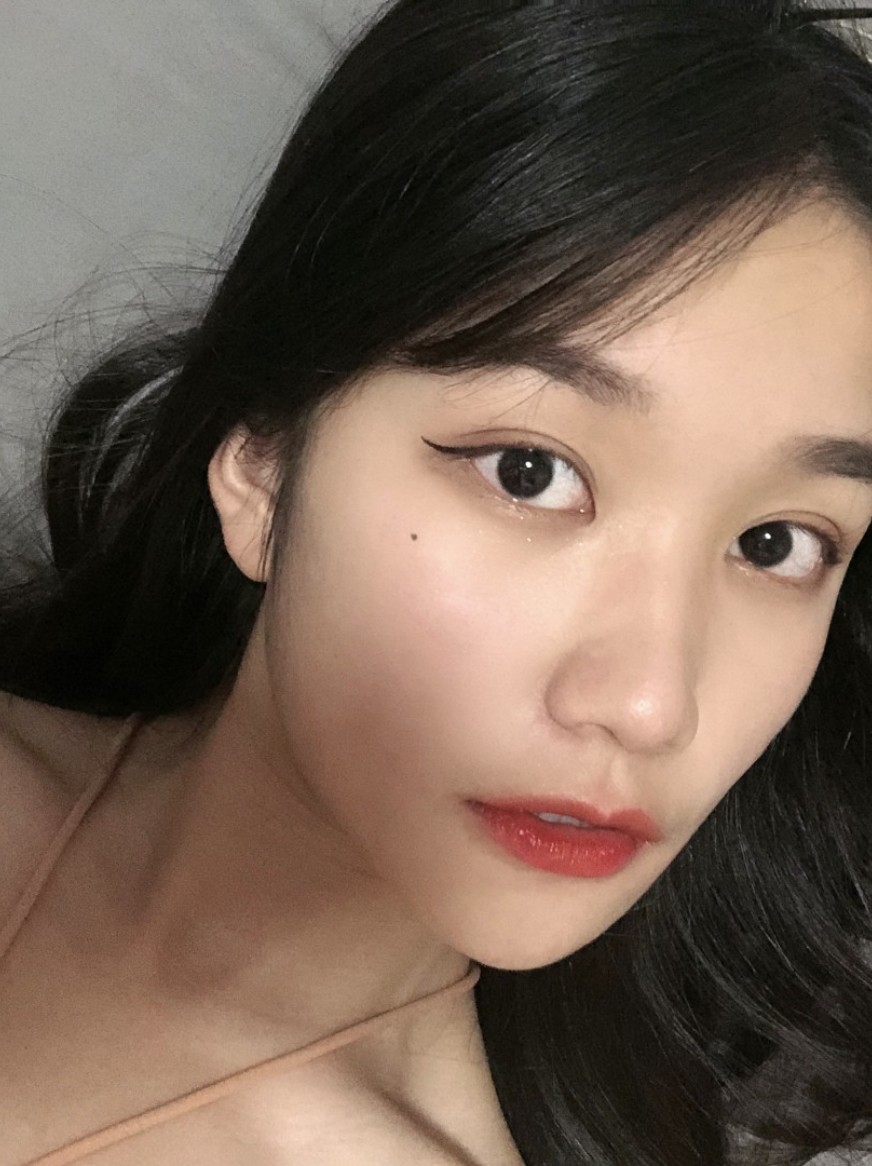 术后90天 最近在网上看到刘亦菲的素颜淡妆真的很_圈子-新氧美容整形