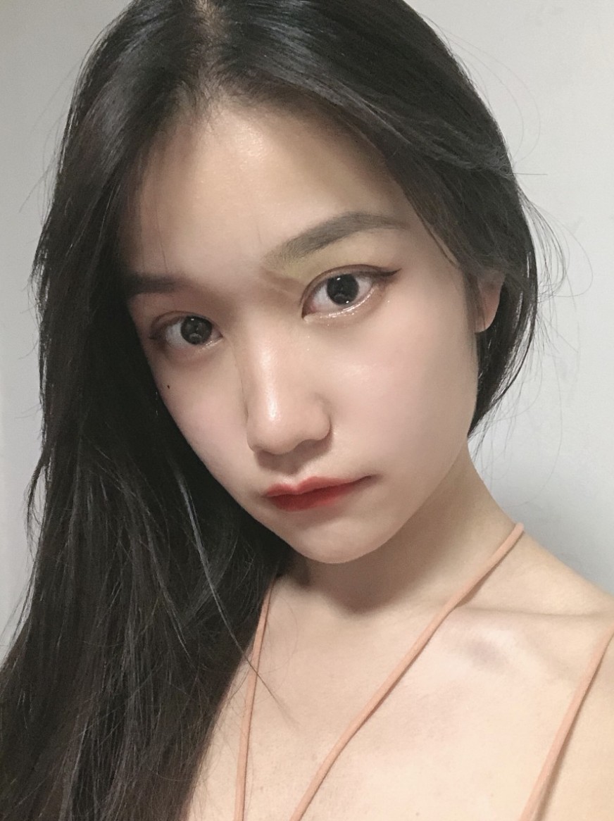 术后90天 最近在网上看到刘亦菲的素颜淡妆真的很_圈子-新氧美容整形