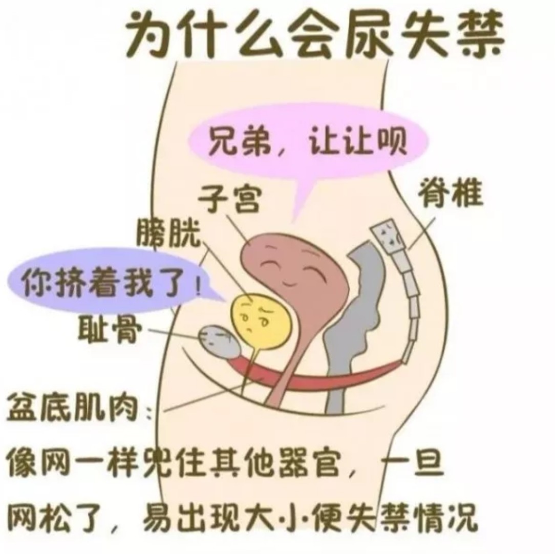 "笑尿了""咳嗽漏尿""喷嚏漏尿"以为原本离我们遥_圈子-新氧美容整形