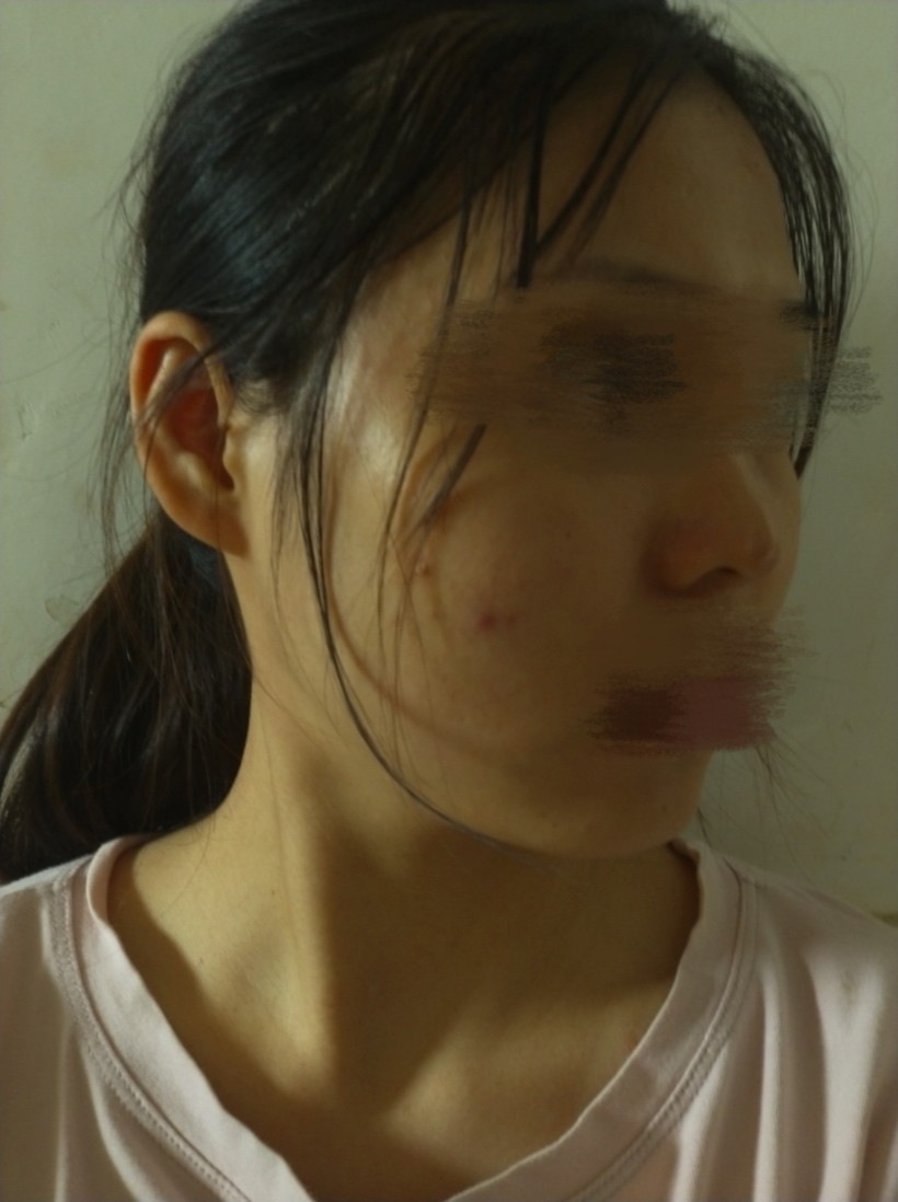 天生皮肤黑黄怎么办?