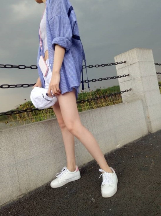 腿的形状抽的很好,恢复的正常了,腿上状况挺好的,没_圈子-新氧美容