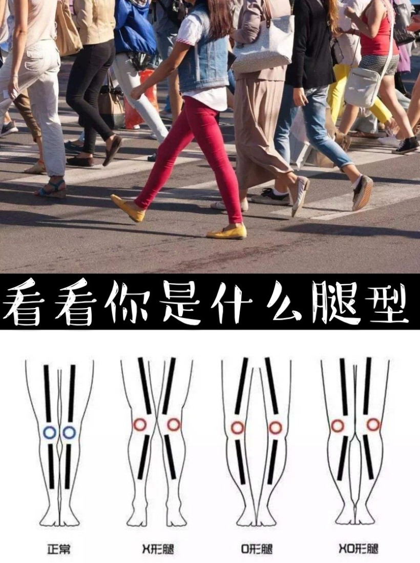 拥有"筷子腿","腿精"等称号的人无一都有着令人羡慕的腿型,笔直,细长