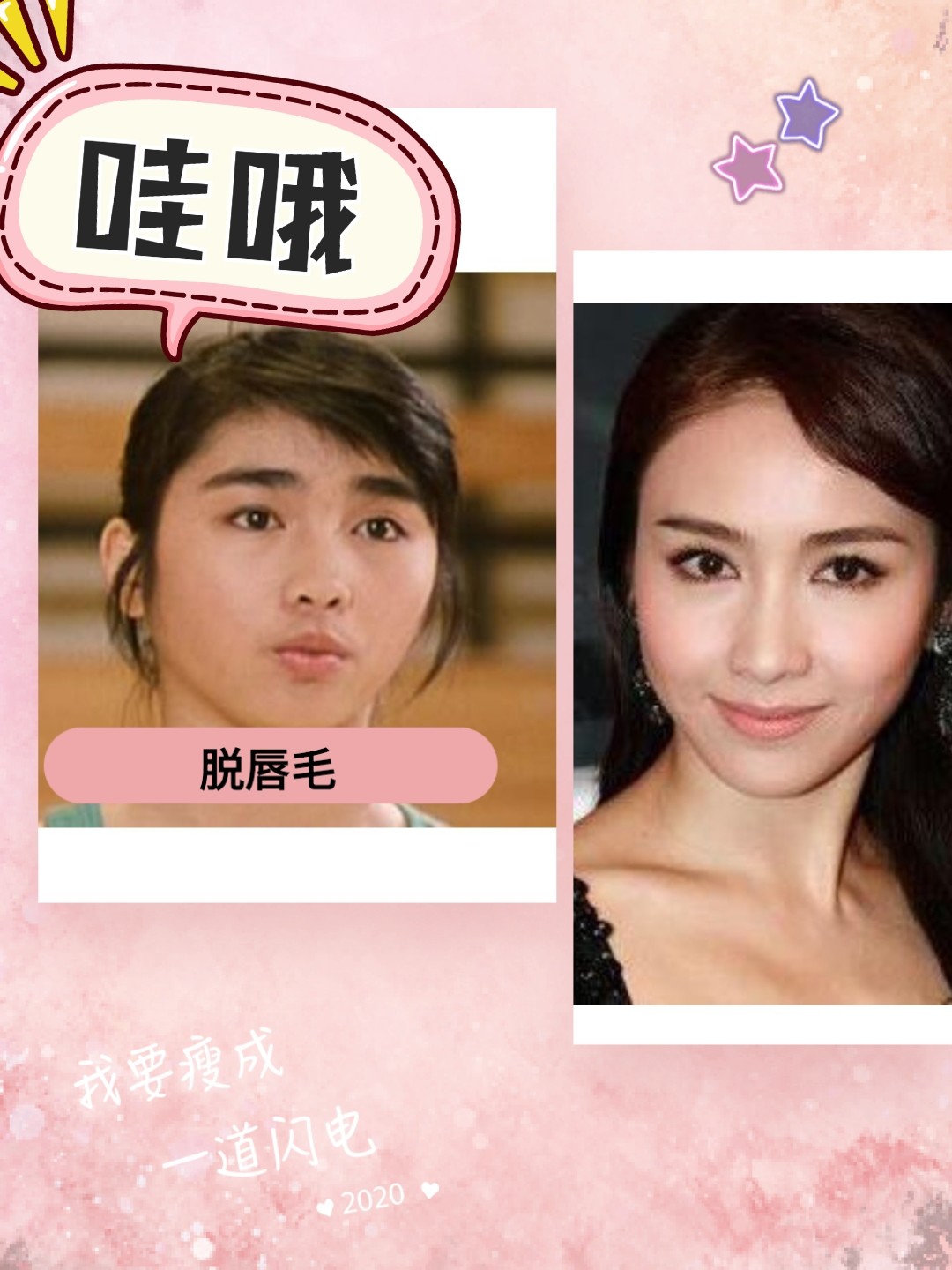 女明星必做的项目脱唇毛,需要注意哪些?