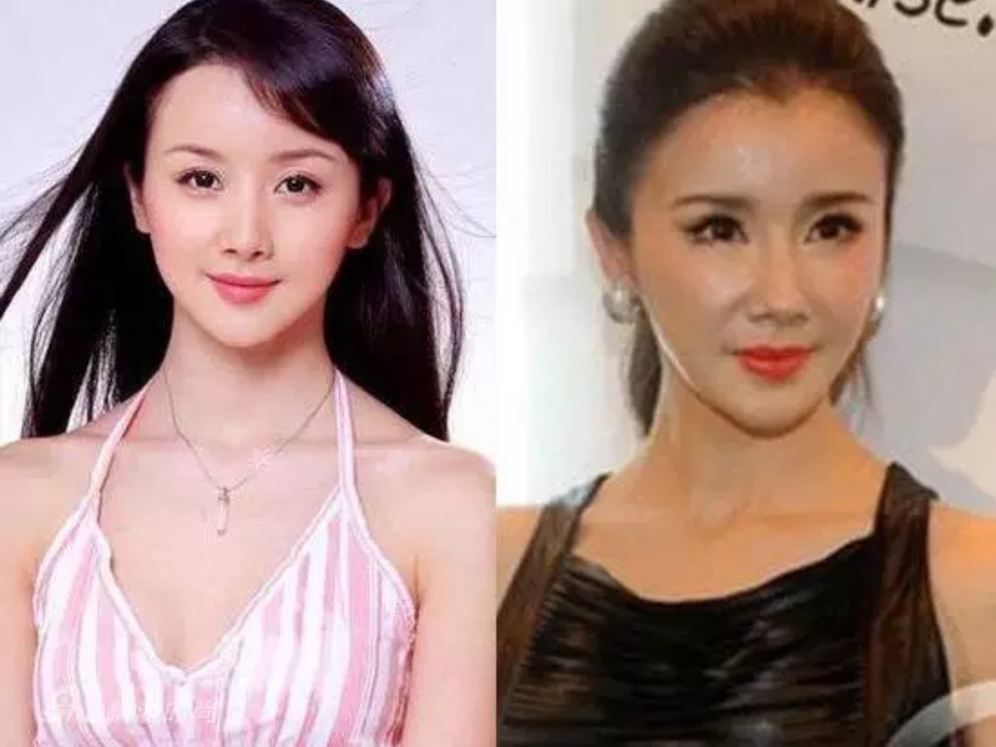 整容上瘾的孙菲菲