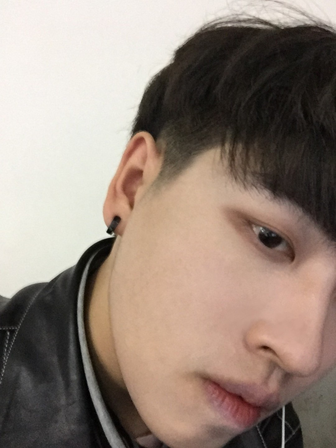 【修脸形案例分享】小帅哥颏肌紧张,下巴后缩导致嘴凸_圈子-新氧美容