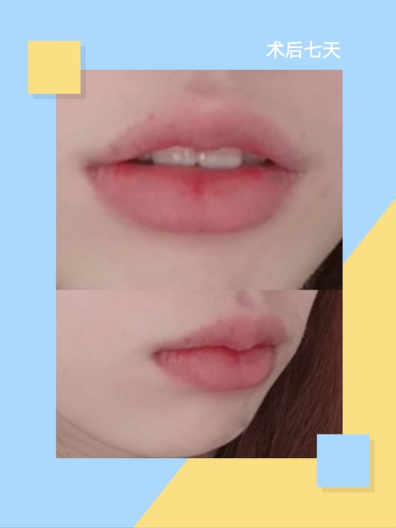 千万不要做花瓣唇,否则你会爱上的