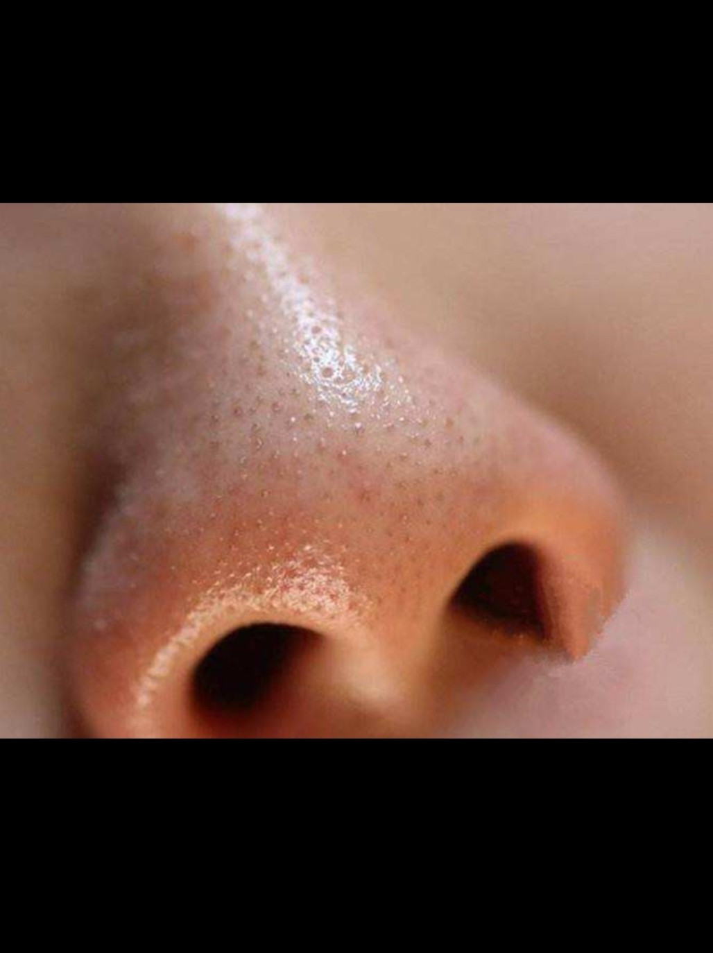 想必大家都有黑头的烦恼,今天来分享几个去黑头的干货_圈子-新氧美容