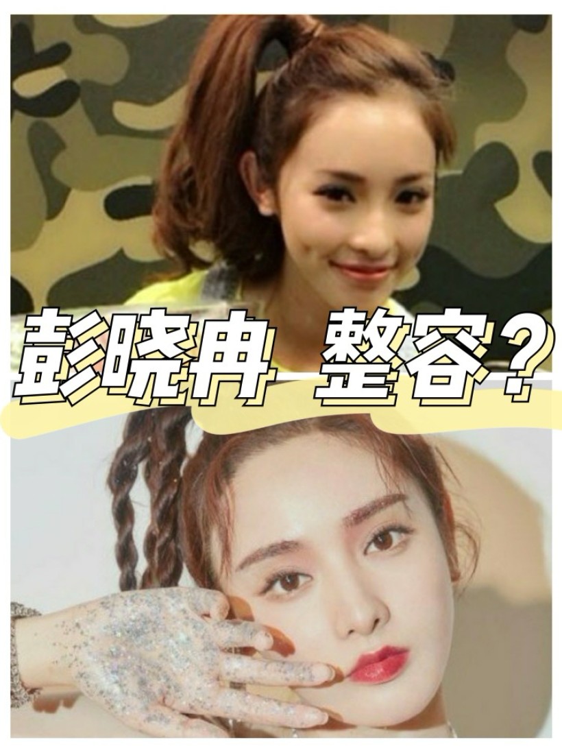 🤔​彭晓冉因为靓丽的长相让很多网友怀疑她有过整容的_圈子-新氧