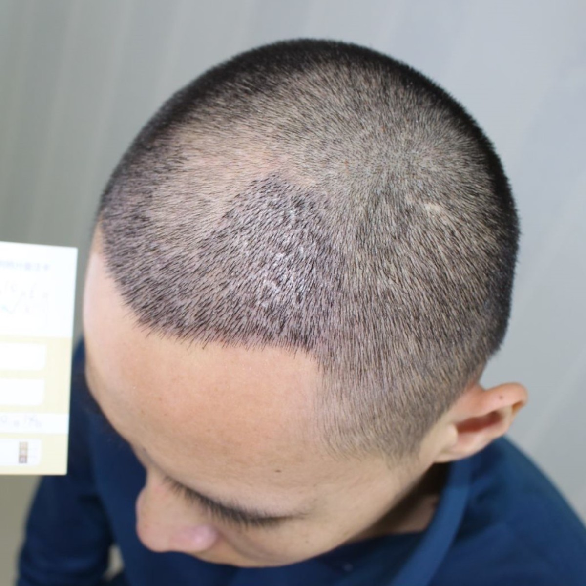 设备,设备先进,解答全_圈子-新氧美容整形